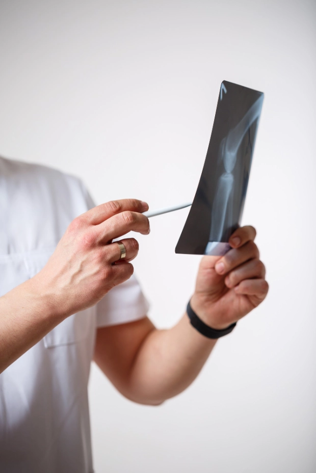 фото рентгена перелома клинике